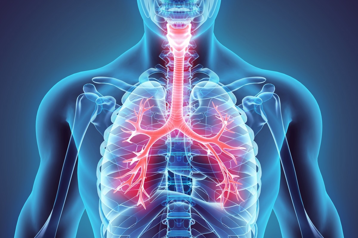 Respiratory Ailments